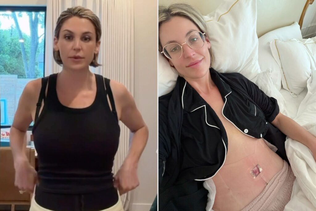 Poppi Co-Founder Allison Ellsworth Details Her ‘Life-Changing’ Tummy Tuck After 3 Babies and Selling Her Company for $2B (Exclusive)
