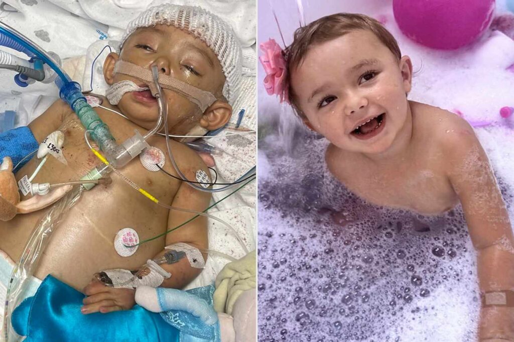 Girl Survived 25 Surgeries, a Liver Transplant and the Loss of 5 Fingers All Before Turning the Age of 3 (Exclusive)