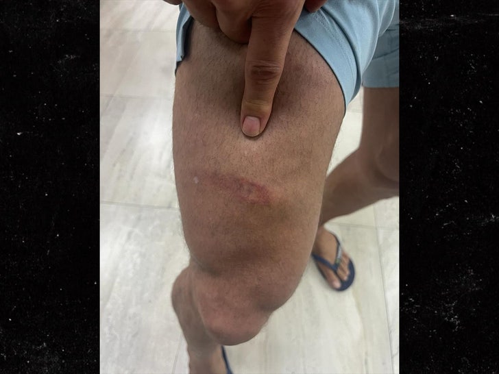 joe francis extortion injury