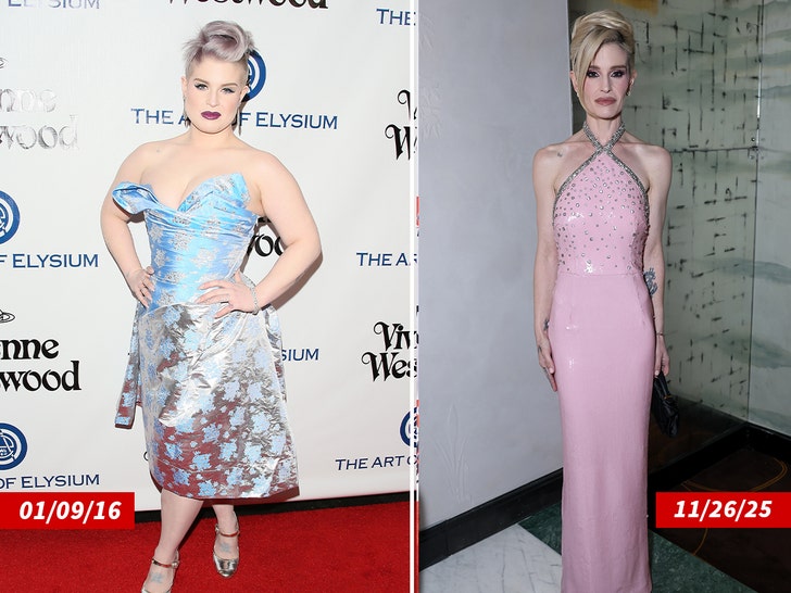 kelly osbourne before after getty