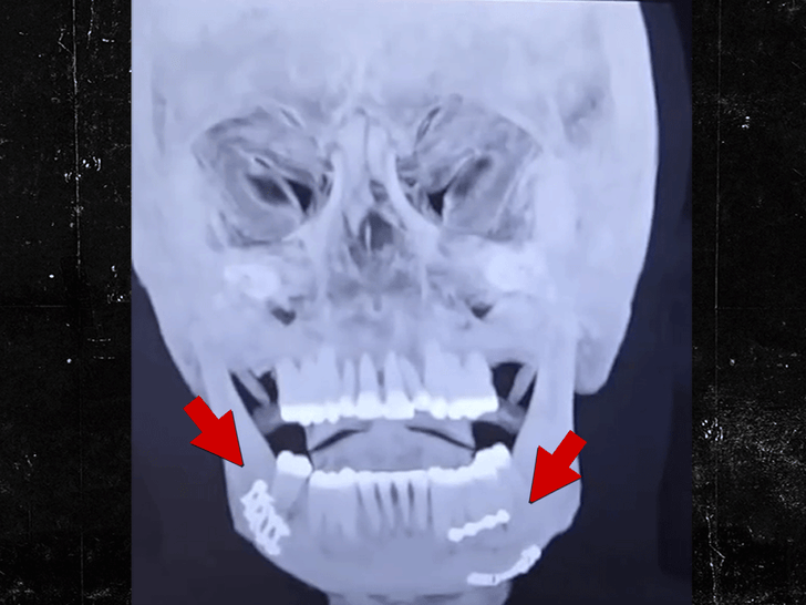 122125_jake_paul_x_ray_primary_v2