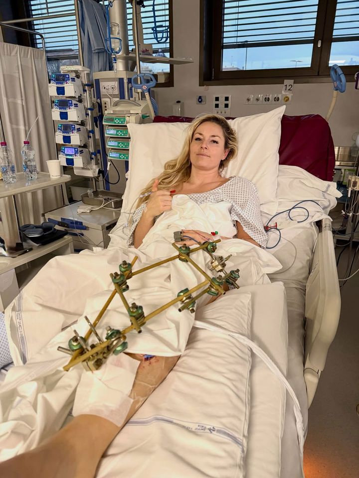 Lindsey Vonn at Ca Foncello hospital in Trevizo, Italy Lindsay Vonn/instagram