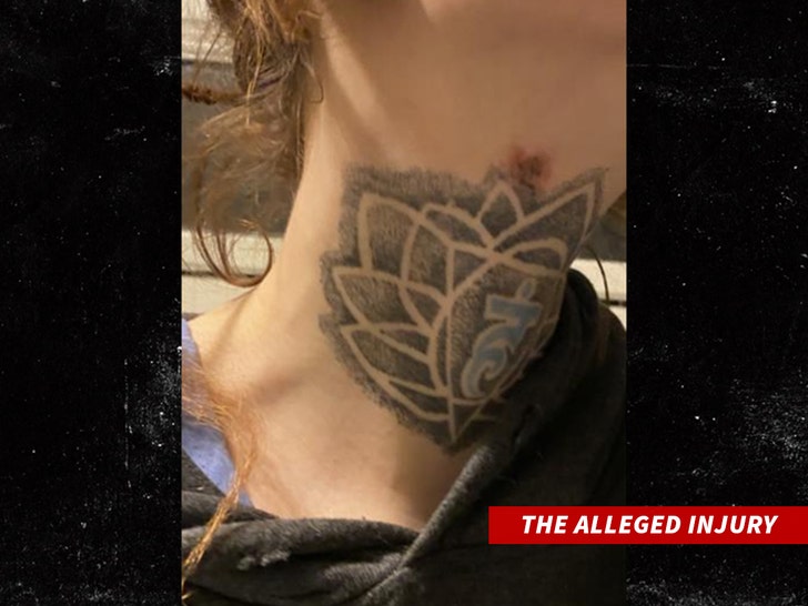 crispin-glover-alleged-injury-sub-1