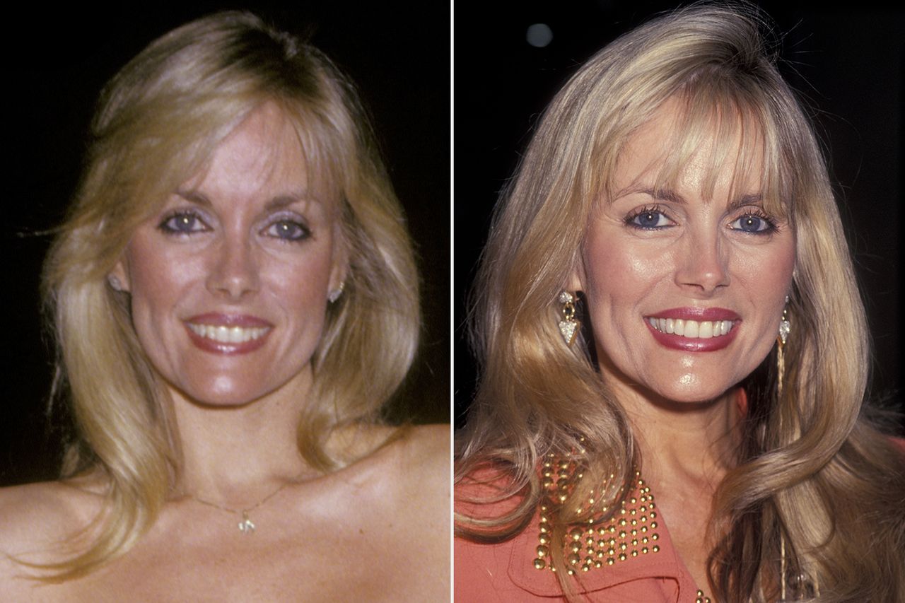 Dian ParkinsonCredit: Ron Galella, Ltd./Ron Galella Collection via Getty (2)