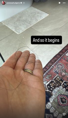 Vanessa Hudgens shows off postpartum hair lossCredit: Vanessa Hudgens/Instagram