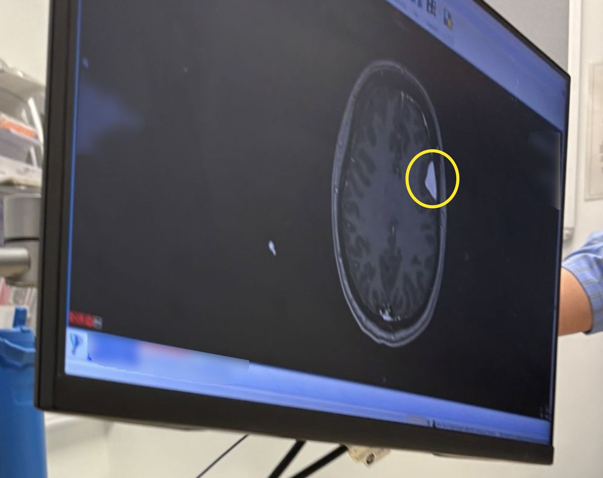 Kerry Sharples' brain scan.Credit: Kennedy News and Media