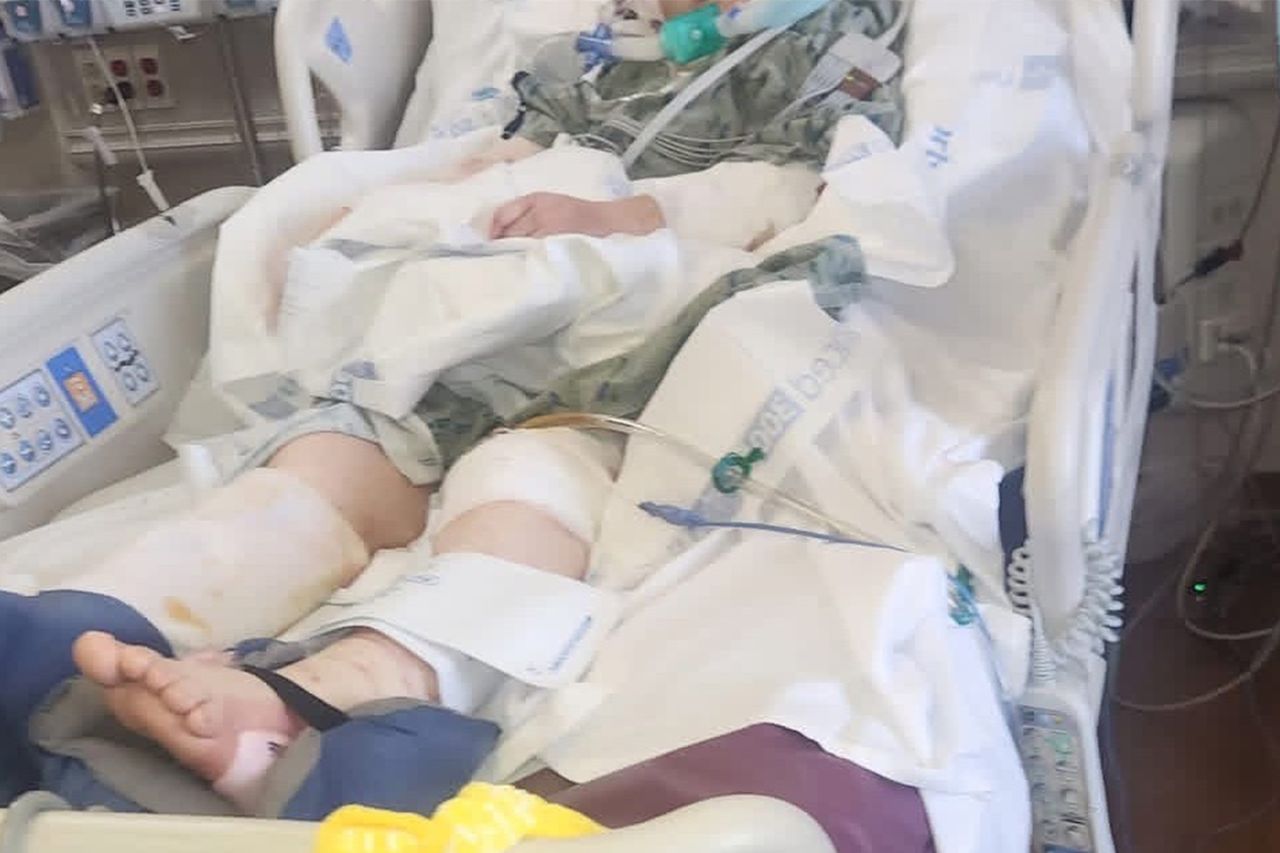 Alicia Maxey in the hospital after several surgeriesCredit: GoFundMe