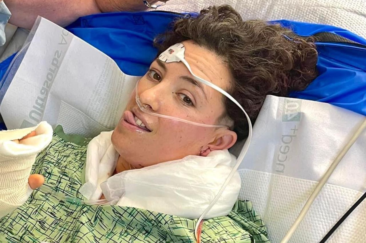 Allie Shehorn in recoveryCredit: Emily MacDonald and Jed Dornoff/GoFundMe