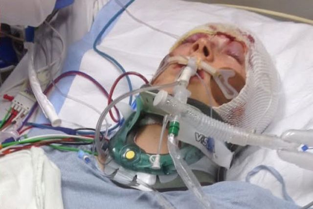 Colby Stevenson in the hospital after 2016 car crash.Credit: Colby Stevenson/Instagram