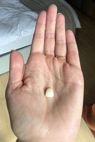 Katrina Kelly's tooth that fell out.Credit: Kennedy News/@katrinakelly23