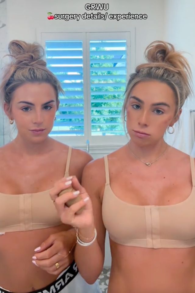 The Cavinder twins post about their breast augmentation surgeriesCredit: Cavinder Twins/TikTok