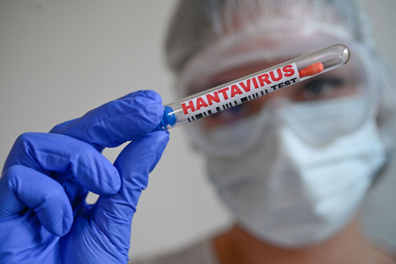 Hantavirus test (stock image)Credit: Joao Luiz Bulcao / Hans Lucas / AFP via Getty