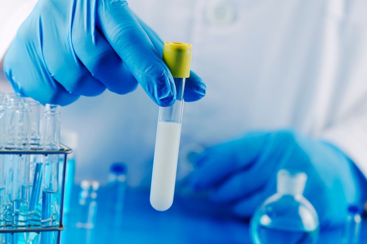 A sperm sample (stock image)Credit: getty