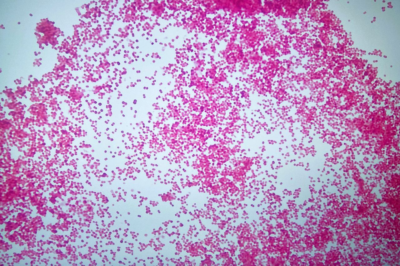 Neisseria meningitidis Neisseria meningitidis under a microscopeCredit: Getty