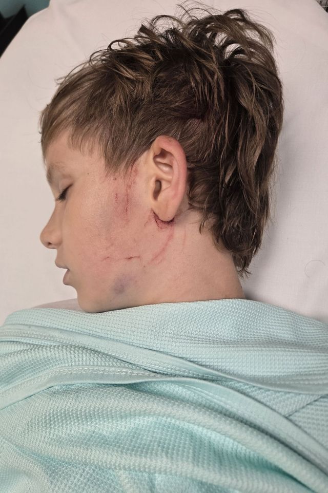 LEWIS COPE, 10, LUCKILY ONLY SUFFERED WITH CUTS AND BRUISES AFTER COLLIDING INTO A CAR WHILE RIDING HIS BIKE) A 10-year-old is lucky to be alive after he ploughed his bike into a moving car - that he didn't hear approach as he was blasting out music. Rich Cope, from Chesterfield, Derbyshire, rushed out the house on June 24 Lewis CopeCredit: Kennedy News and Media