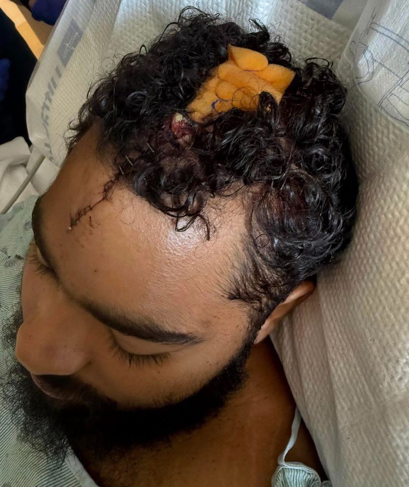 Man, 23, Is Searching for Good Samaritans who pulled him from Highway Car Crash: ‘They saved my life’ An injure Zach Seaback in the hospital after his rollover crashCredit: GoFundMe