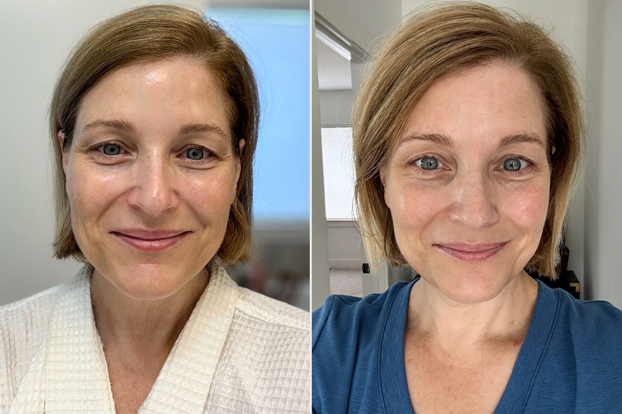 Before (left) and after (right).Credit: People (2)