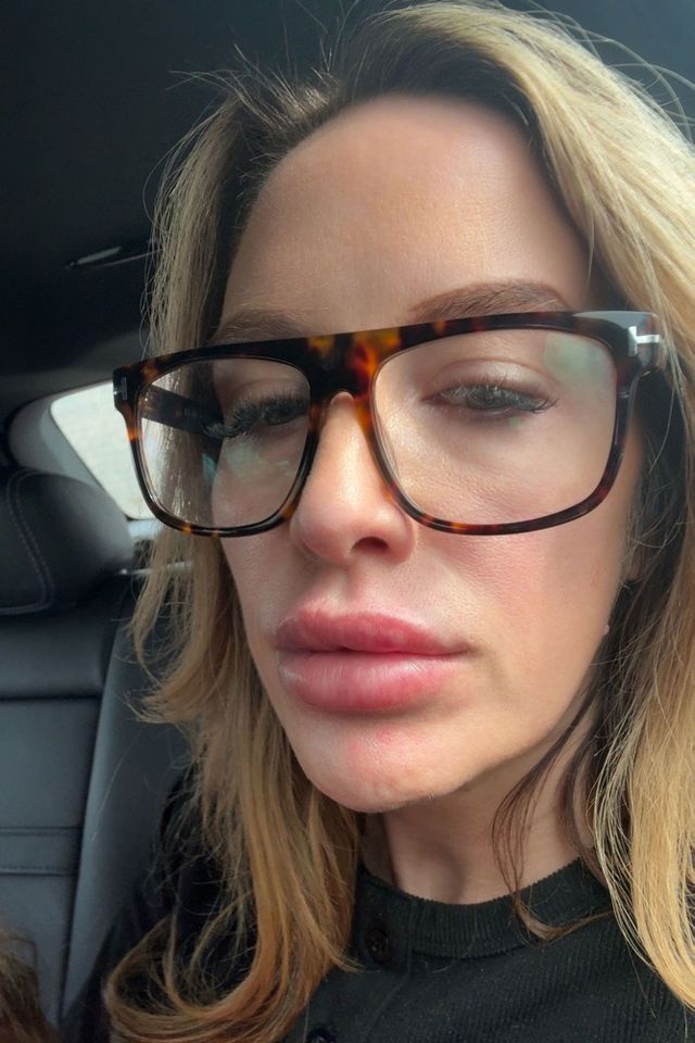 Mom Danielle Bryce said she was “obsessed” with lip fillers.Credit: Kennedy News/daniellebrycey