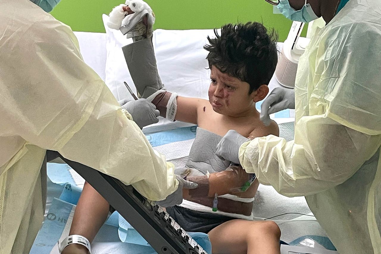 7-year-old boy burned in fire after science experiment with household items goes wrong Elian Flores Elian FloresCredit: GoFundMe