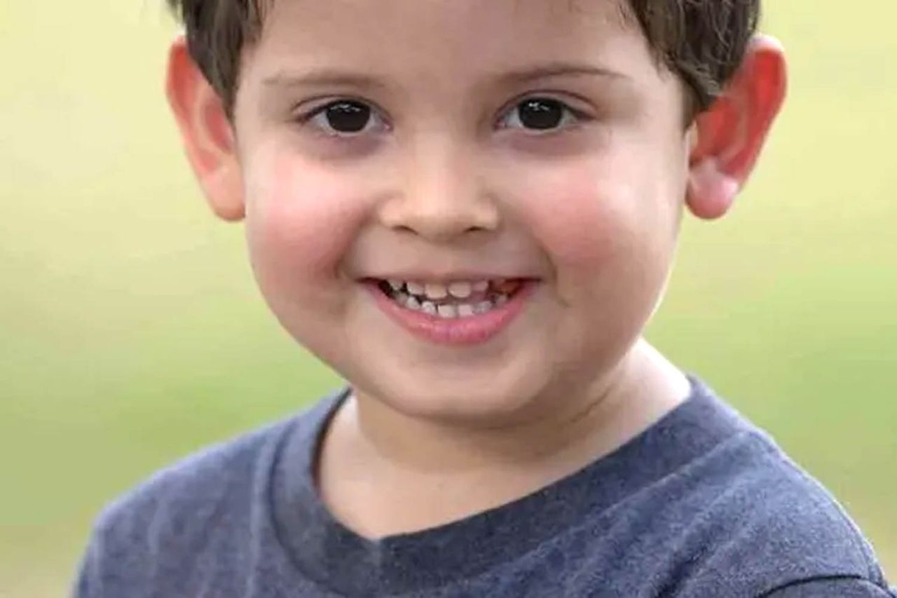 7-year-old boy burned in fire after science experiment with household items goes wrong Elian Flores Elian FloresCredit: GoFundMe