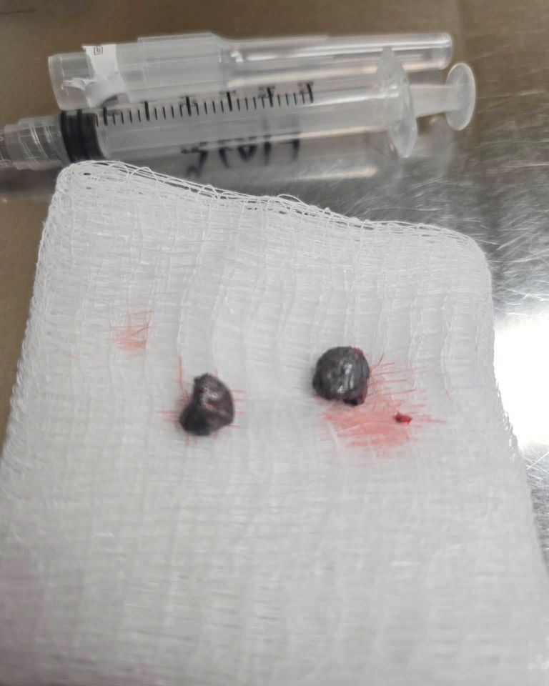 Two of the bullet fragments removed from Mercy’s head during surgery on Aug. 31Credit: Brown County Humane Society Dog Shelter/Facebook